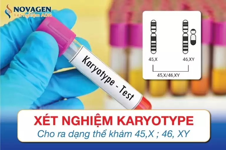 Xét Nghiệm Karyotype Cho Ra Dạng Thể Khảm 45,X ; 46, XY