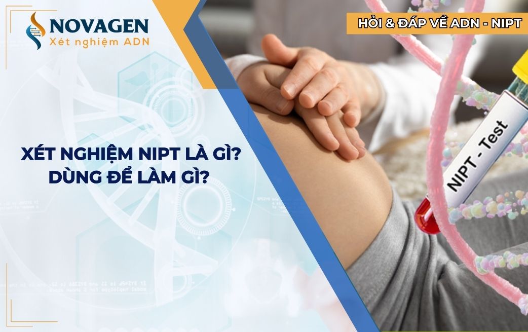 Xét nghiệm NIPT là gì? NIPT dùng để làm gì? 