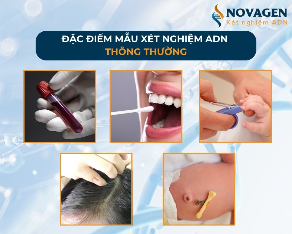 Xét nghiệm ADN cần lấy mẫu gì? Nên chọn mẫu gì để xét nghiệm ADN?