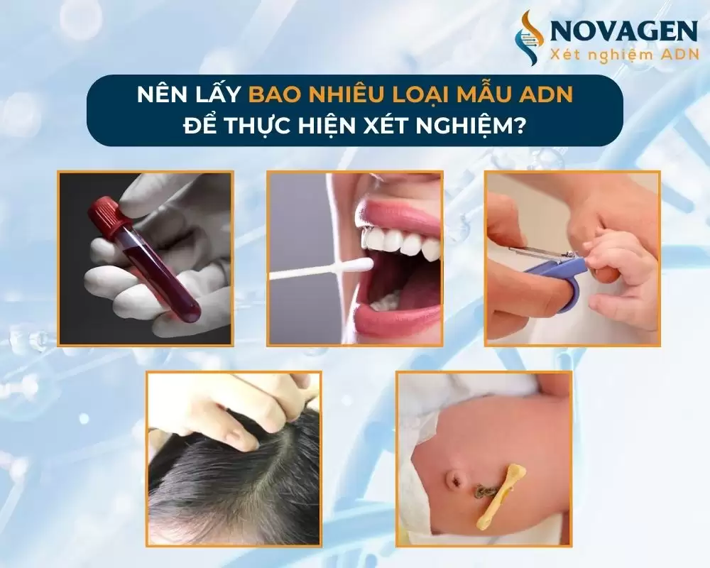 Cần bao nhiêu mẫu để thực hiện xét nghiệm ADN?