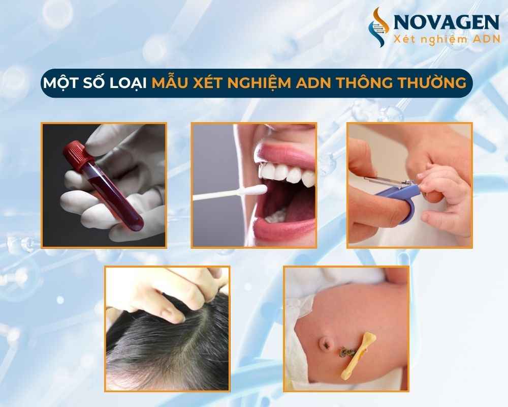 Làm ADN nhanh chậm kết quả có giống nhau không?