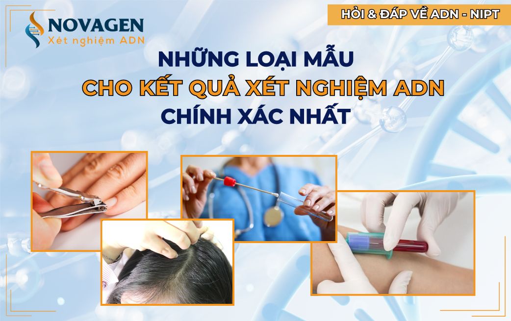 Những loại mẫu cho kết quả xét nghiệm ADN chính xác nhất