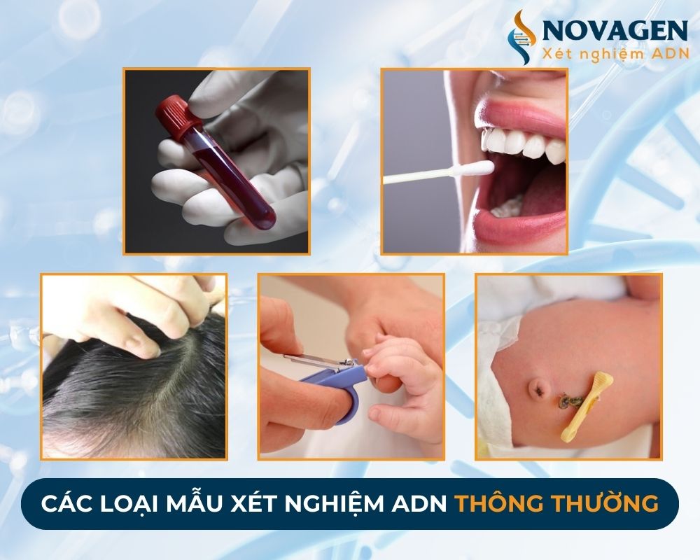 Những loại mẫu cho kết quả xét nghiệm ADN chính xác nhất