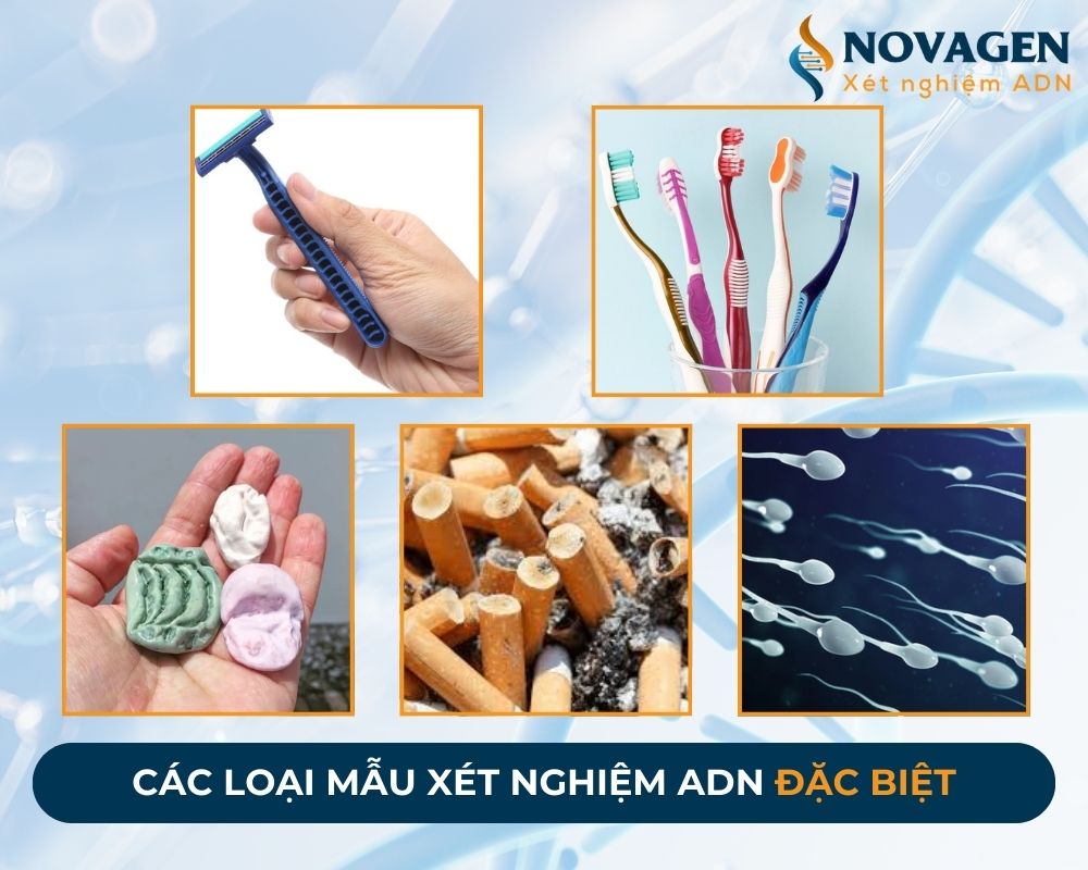 Những loại mẫu cho kết quả xét nghiệm ADN chính xác nhất