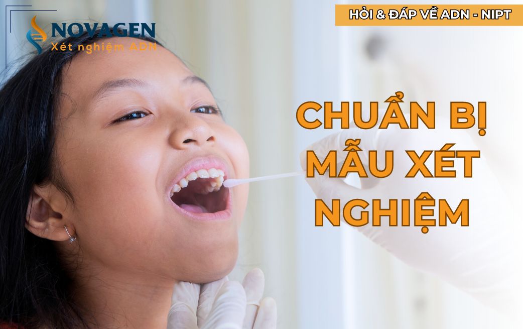 Chuẩn bị mẫu xét nghiệm ADN