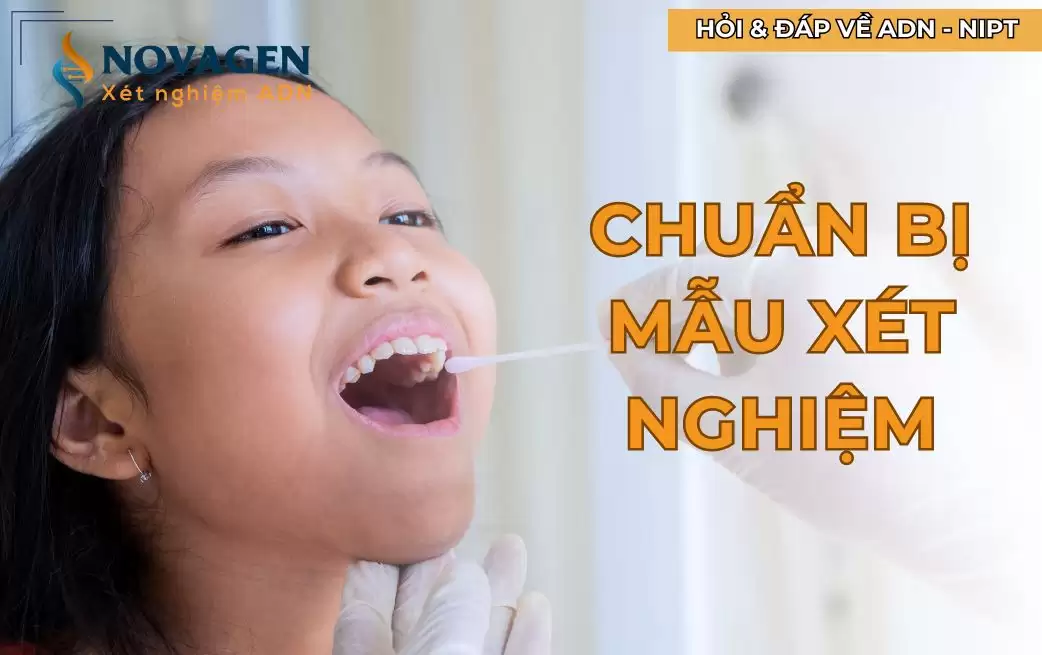 Chuẩn bị mẫu xét nghiệm ADN