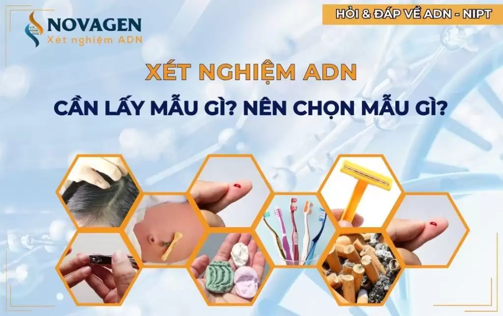 Xét nghiệm ADN cần lấy mẫu gì? Nên chọn mẫu gì để xét nghiệm ADN?