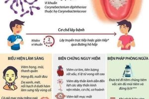 Bệnh bạch hầu nguy hiểm thế nào? Cách phòng bệnh bạch hầu