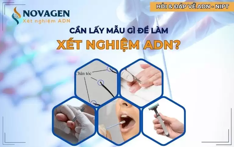Cần lấy mẫu gì để làm xét nghiệm ADN?