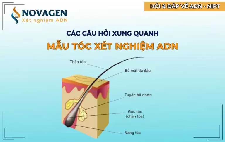 Giải đáp các câu hỏi xung quanh mẫu tóc xét nghiệm ADN