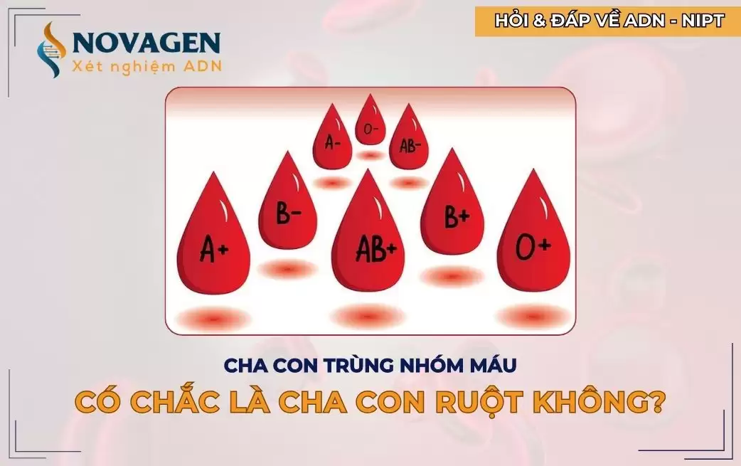 Cha con trùng nhóm máu thì có chắc là cha con ruột không?