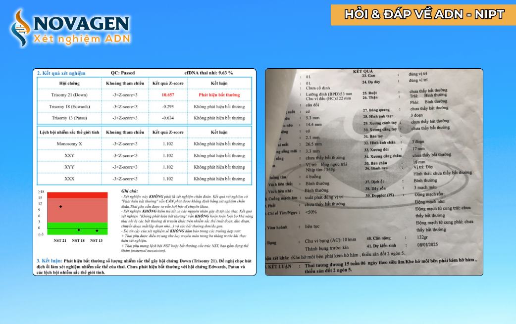 4. Các giai đoạn thực hiện xét nghiệm