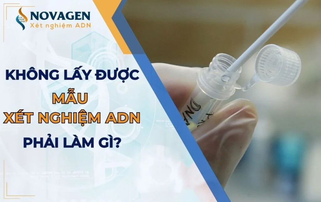 Khi không lấy được mẫu xét nghiệm ADN phải làm gì? 
