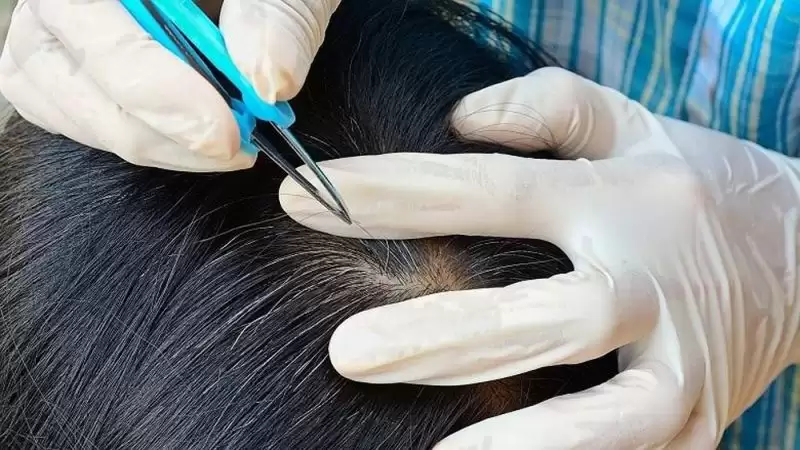lấy mẫu tóc để xét nghiệm ADN tại nhà