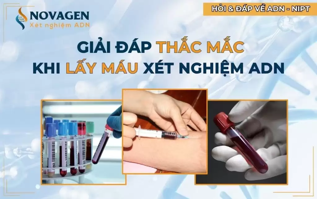 Lấy máu xét nghiệm ADN cần những gì? Giải đáp từ chuyên gia 2025