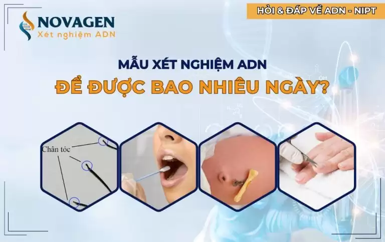 Mẫu xét nghiệm ADN để được bao nhiêu ngày? Một số câu hỏi thường gặp