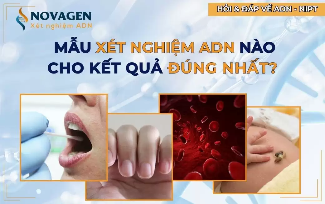 Mẫu xét nghiệm ADN nào cho kết quả đúng nhất? 