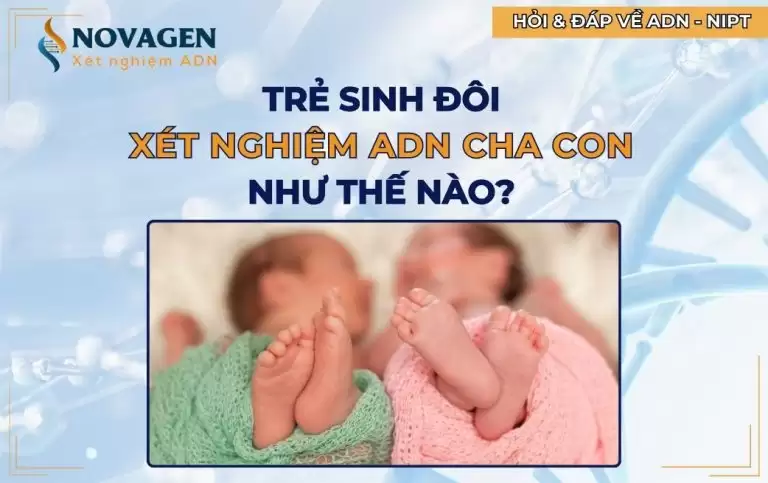 Sinh đôi thì xét nghiệm ADN bố con thế nào?