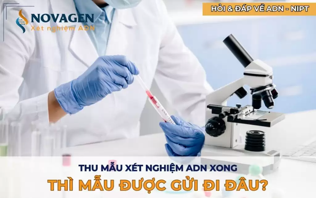 Thu mẫu xét nghiệm ADN xong thì mẫu được gửi đi đâu?