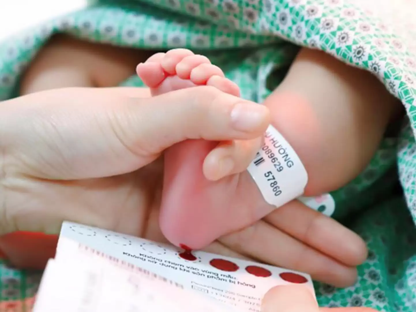 Trẻ sơ sinh xét nghiệm ADN dùng mẫu gì?