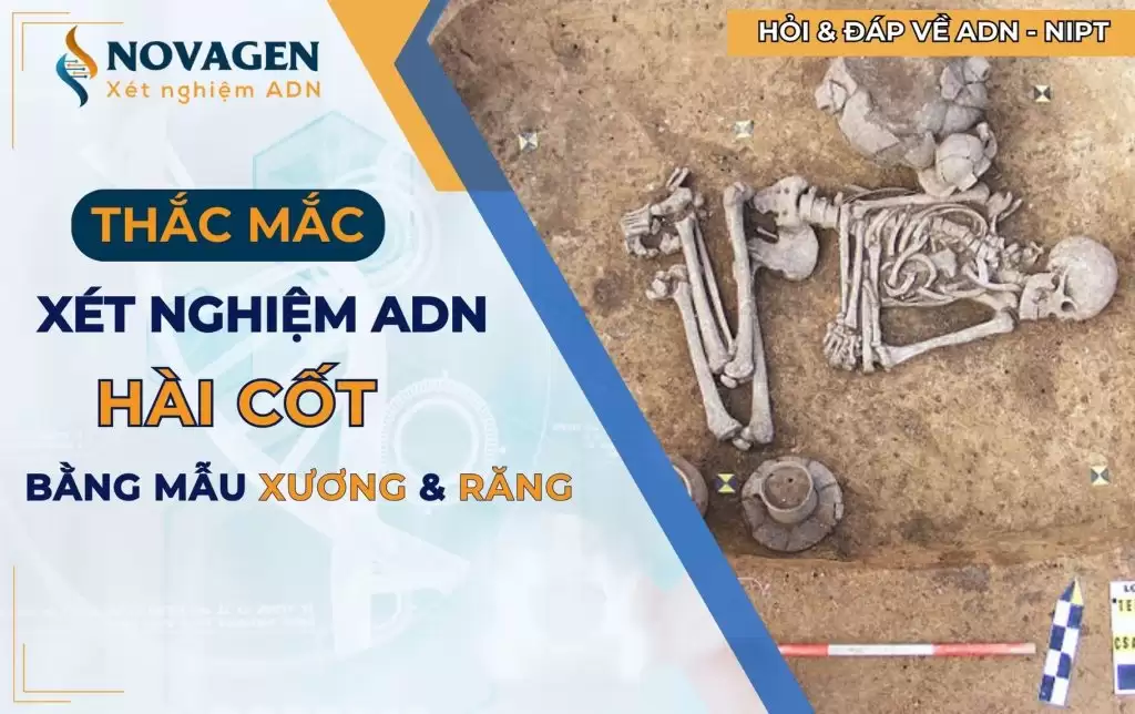 Một số thắc mắc về xét nghiệm ADN hài cốt bằng xương và răng