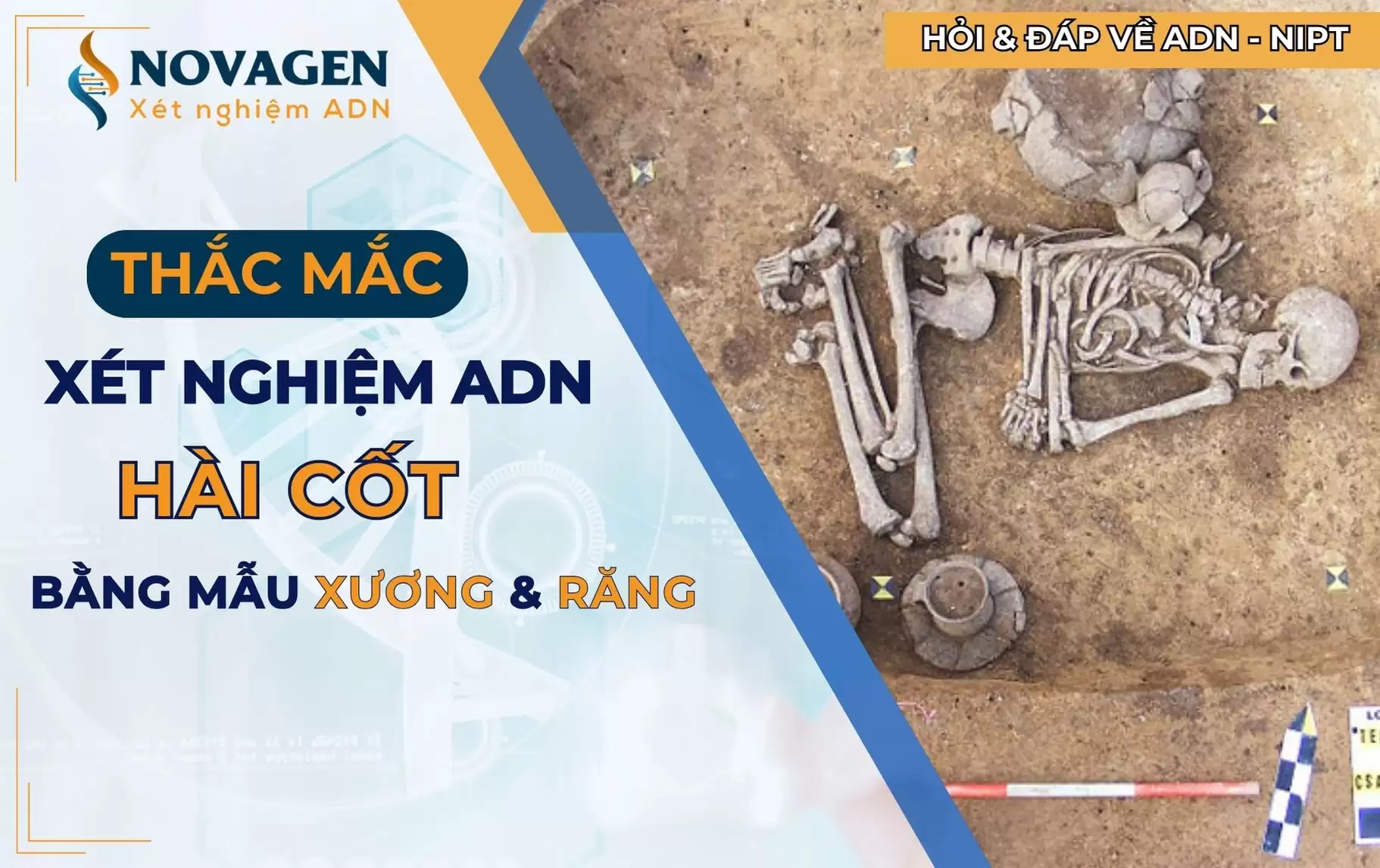 xét nghiệm ADN hài cốt bằng xương và răng
