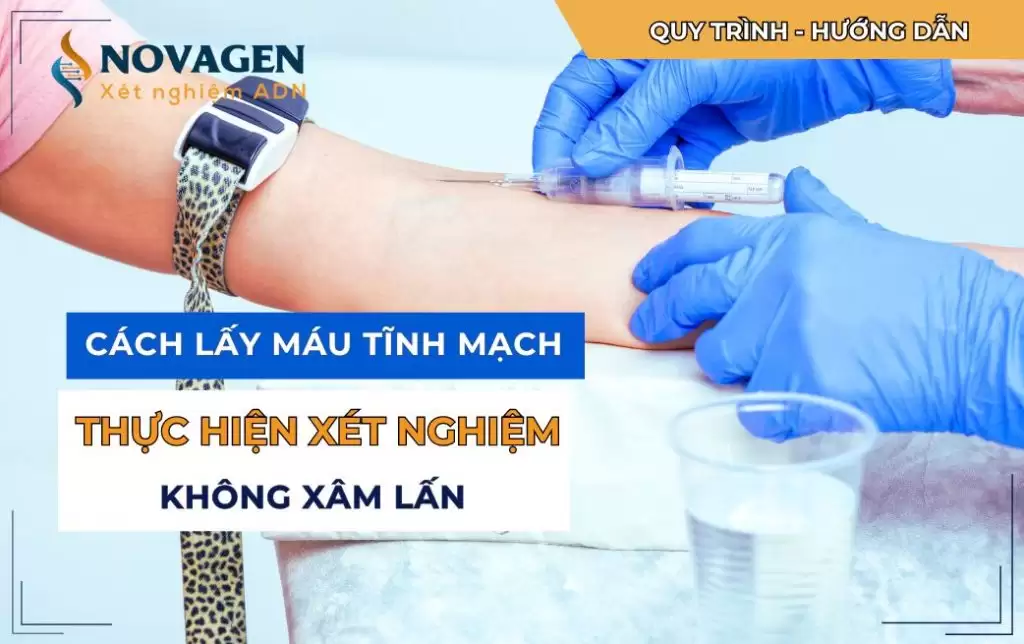 Cách lấy máu tĩnh mạch của mẹ bầu thực hiện xét nghiệm không xâm lấn