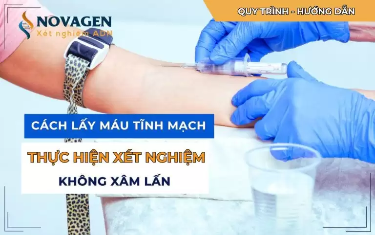 Cách lấy máu tĩnh mạch của mẹ bầu thực hiện xét nghiệm không xâm lấn