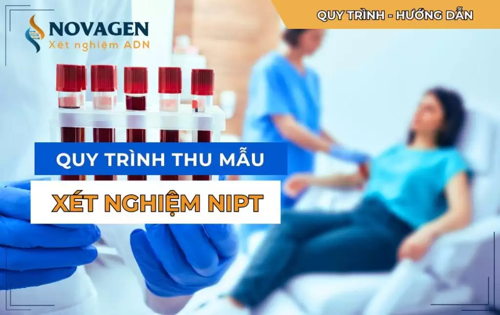 Quy trình thu mẫu xét nghiệm NIPT