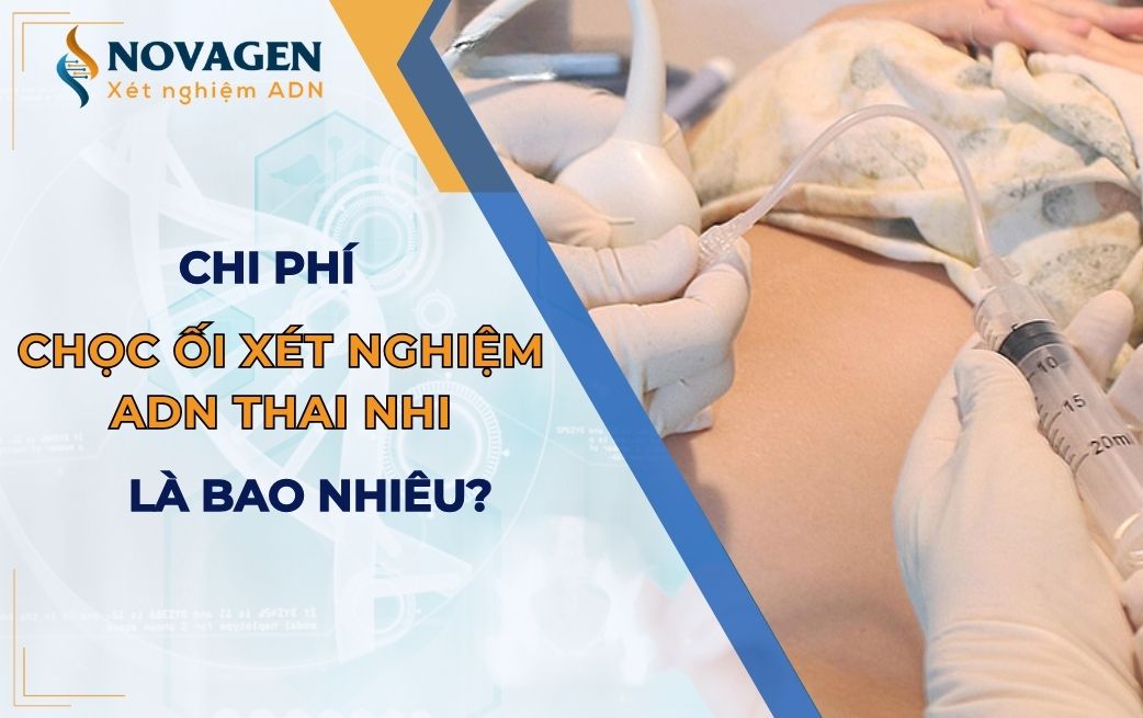 Chi phí chọc ối xét nghiệm ADN thai nhi là bao nhiêu?