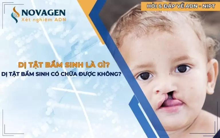 Dị tật bẩm sinh là gì? Dị tật bẩm sinh có chữa được không?