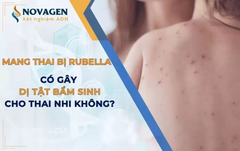 Phụ nữ mang thai bị Rubella có nguy cơ gây dị tật bẩm sinh cho thai nhi không?
