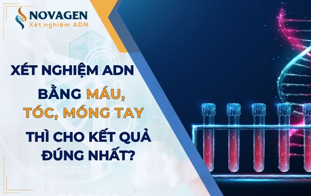 Xét nghiệm ADN bằng máu hay tóc với móng tay đúng nhất