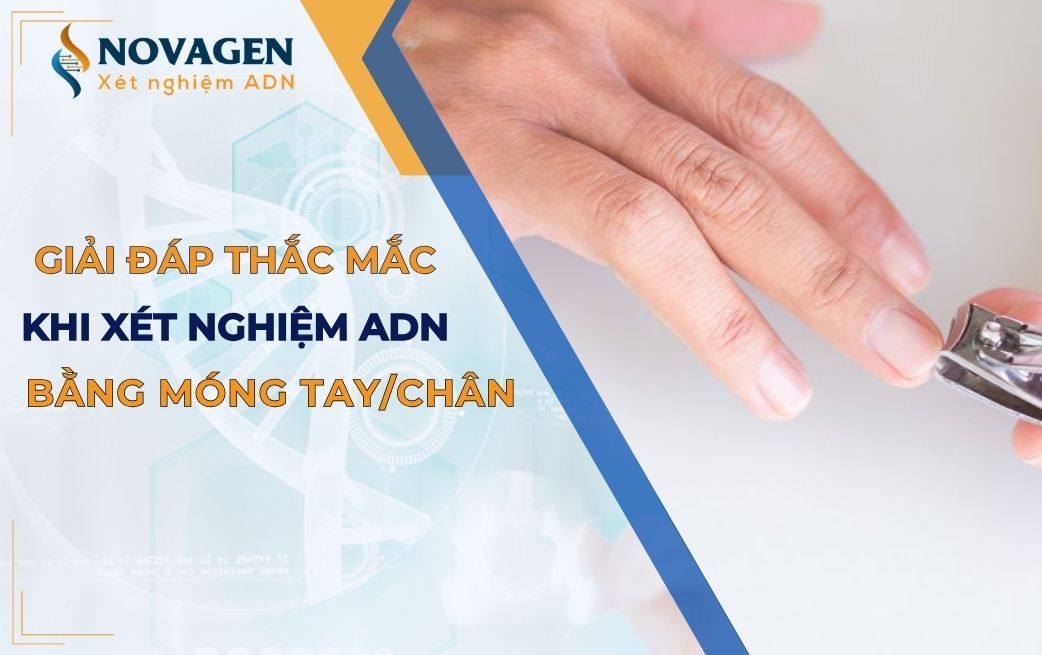 Giải đáp thắc mắc khi làm xét nghiệm ADN bằng móng tay, chân