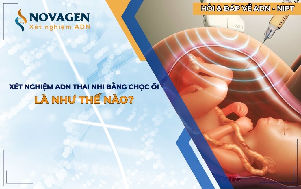 Xét nghiệm ADN thai nhi bằng chọc ối là như thế nào?