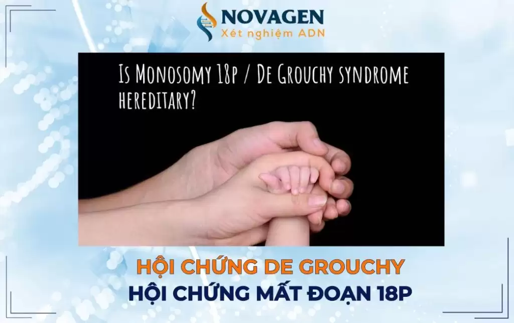 Hội chứng De Grouchy – Hội chứng mất đoạn 18p