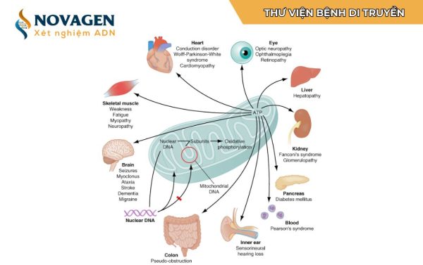 Bệnh ty thể (Mitochondrial disease)