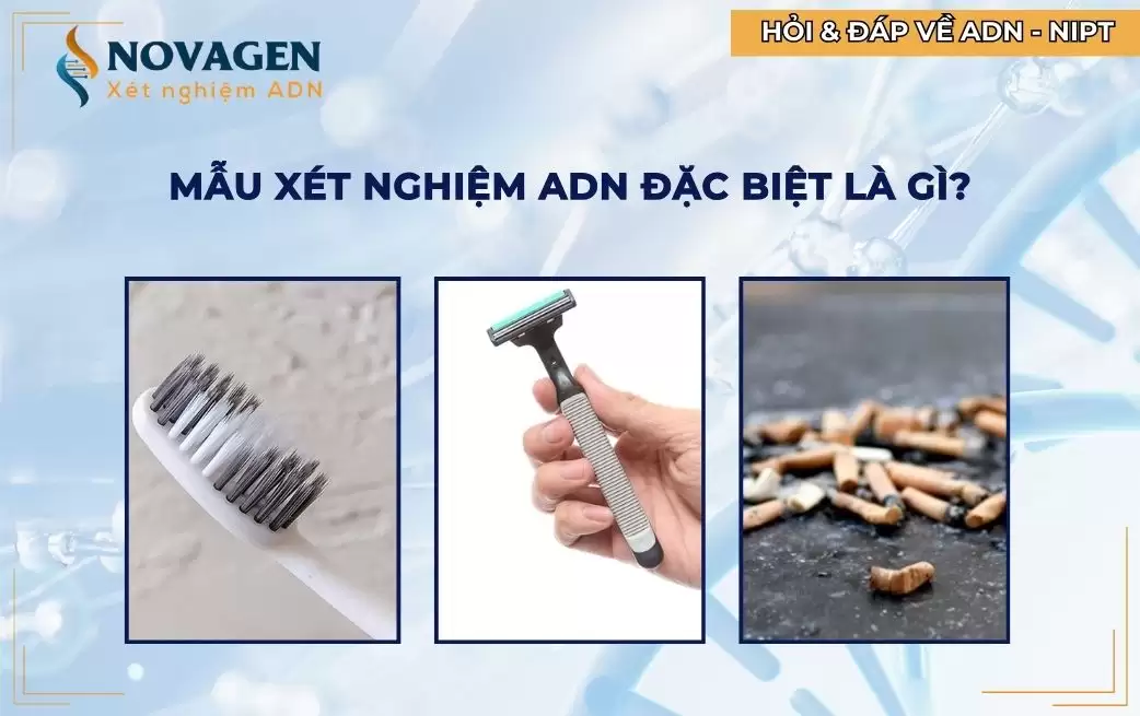 Mẫu xét nghiệm ADN đặc biệt là gì? Các loại mẫu ADN đặc biệt