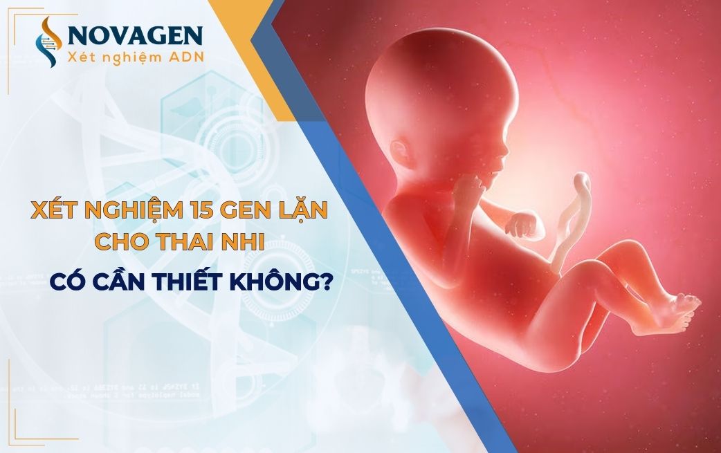 Xét nghiệm 15 gen lặn cho thai nhi là gì? Có cần thiết không?