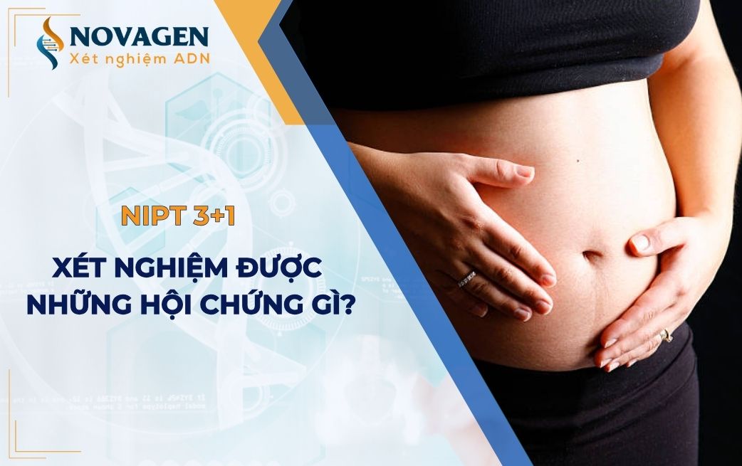 Gói xét nghiệm NIPT 3+1 sàng lọc được những hội chứng nào?