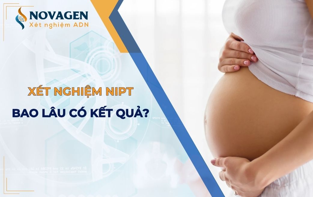 Xét nghiệm NIPT bao lâu có kết quả?