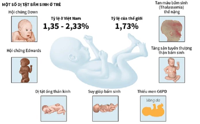 Một số dị tật bẩm sinh ở trẻ em