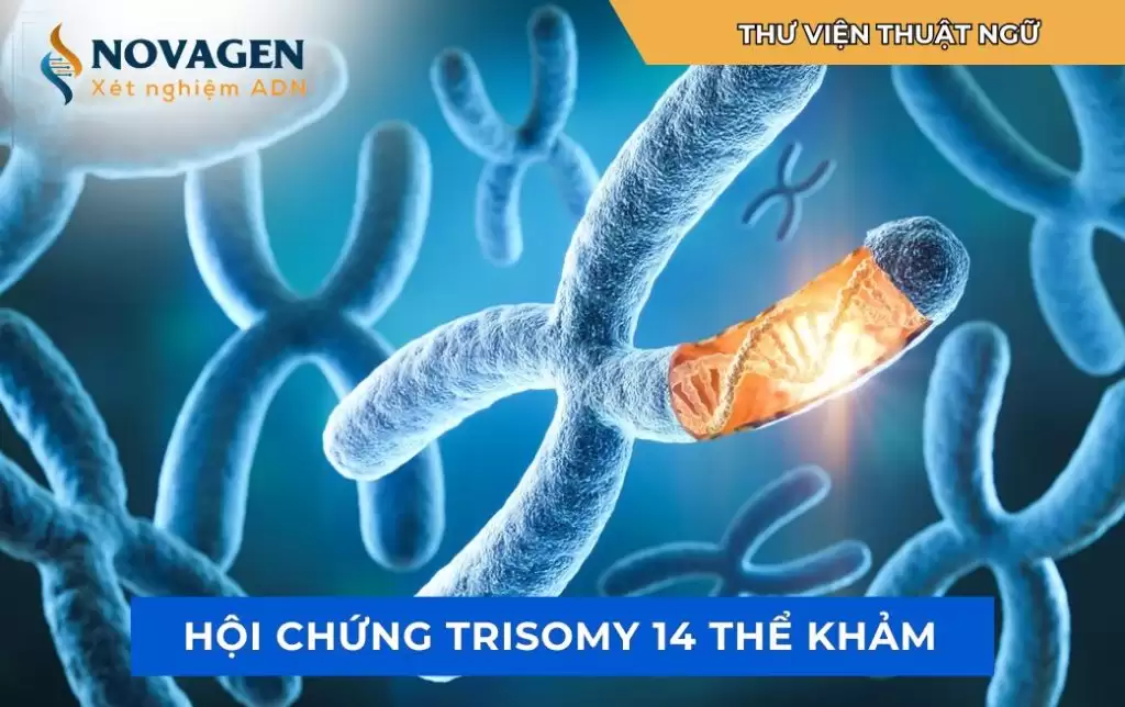 Hội chứng Trisomy 14 thể khảm: Nguyên nhân, triệu chứng và hướng điều trị