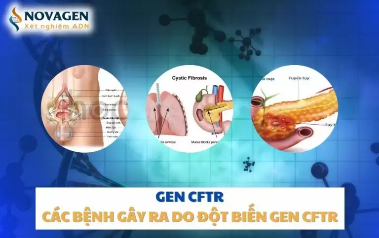 Gen CFTR là gì? Các bệnh gây ra do đột biến gen CFTR