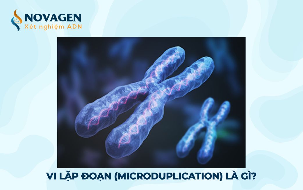 Vi lặp đoạn (Microduplication) và hội chứng vi lặp đoạn là gì?