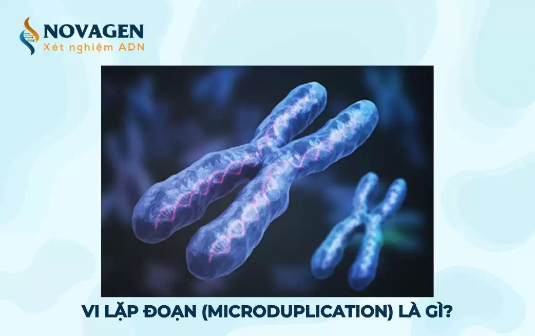 Vi lặp đoạn (Microduplication) và hội chứng vi lặp đoạn là gì?