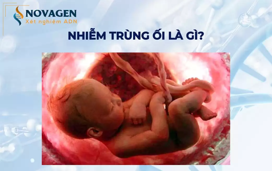 Nhiễm trùng ối là gì? Chọc ối có gây nhiễm trùng ối? 