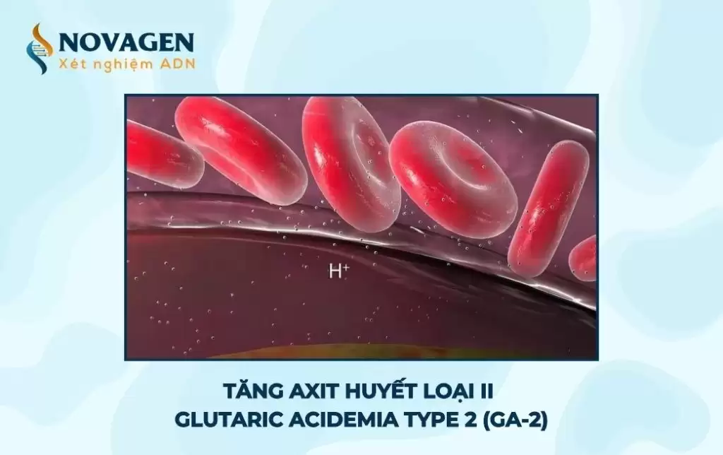 Tăng axit huyết loại 2 – Glutaric acidemia type 2 (GA-2) là bệnh gì? 