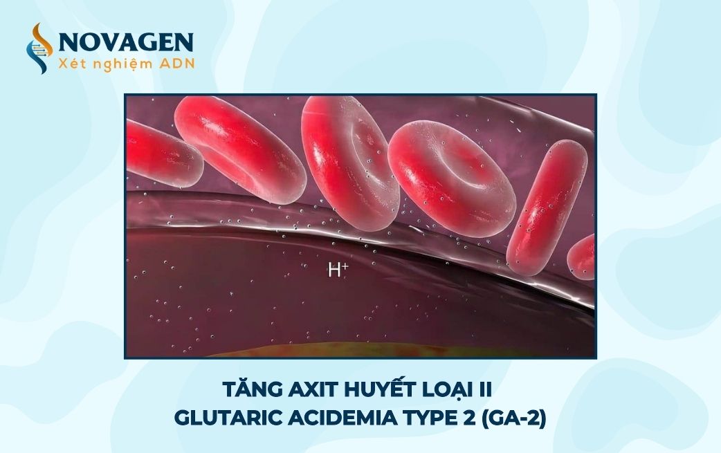 Tăng axit huyết loại 2 - Glutaric acidemia type 2 (GA-2) là bệnh gì? 