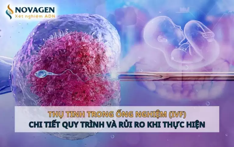 Thụ tinh trong ống nghiệm (IVF) – Chi tiết quy trình và rủi ro khi thực hiện